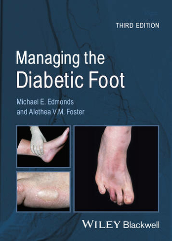 Managing the Diabetic Foot: (3rd edition)