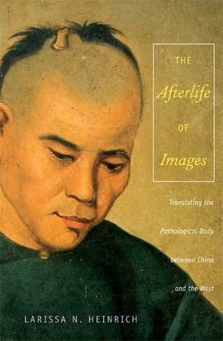 The Afterlife of Images: Translating the Pathological Body between China and the West (Body, Commodity, Text)
