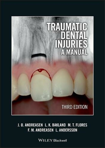 Traumatic Dental Injuries: A Manual (3rd edition)