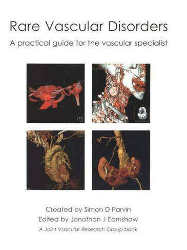 Rare Vascular Disorders: A practical guide for the vascular specialist