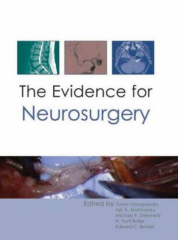 The Evidence for Neurosurgery