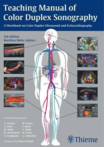 Teaching Manual of Color Duplex Sonography: (3rd Edition)