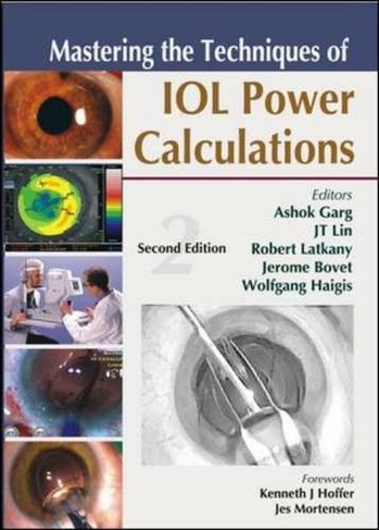 Mastering the Techniques of IOL Power Calculations, Second Edition: (2nd edition)