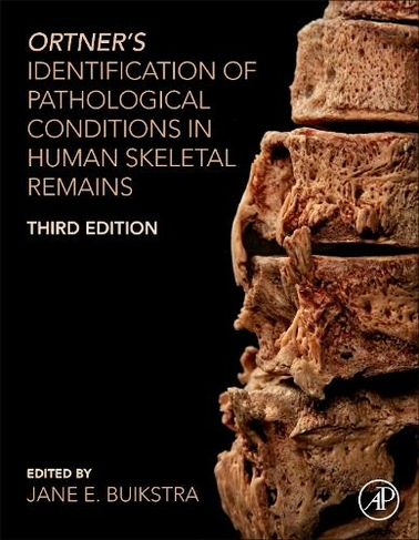 Ortner's Identification of Pathological Conditions in Human Skeletal Remains: (3rd edition)