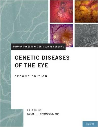 Genetic Diseases of the Eye: (Oxford Monographs on Medical Genetics 13 2nd Revised edition)