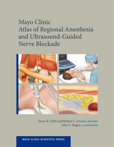 Mayo Clinic Atlas of Regional Anesthesia and Ultrasound-Guided Nerve Blockade: (Mayo Clinic Scientific Press)