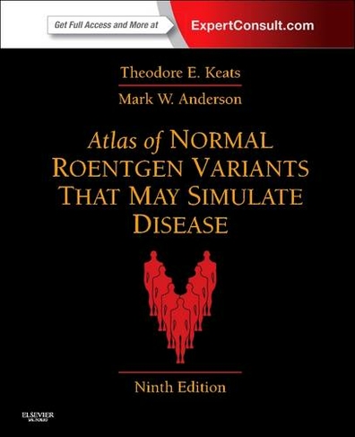 Atlas of Normal Roentgen Variants That May Simulate Disease: Expert Consult - Enhanced Online Features and Print (9th edition)