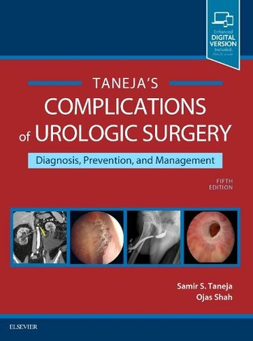 Complications of Urologic Surgery: Prevention and Management (5th edition)