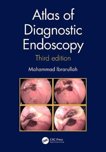 Atlas of Diagnostic Endoscopy, 3E: (3rd edition)