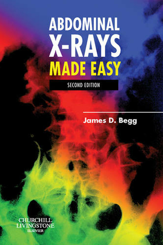 Abdominal X-Rays Made Easy: (Made Easy 2nd edition)
