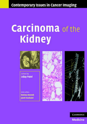 Carcinoma of the Kidney: (Contemporary Issues in Cancer Imaging)