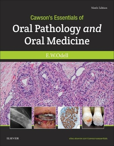 Cawson's Essentials of Oral Pathology and Oral Medicine: (9th edition)