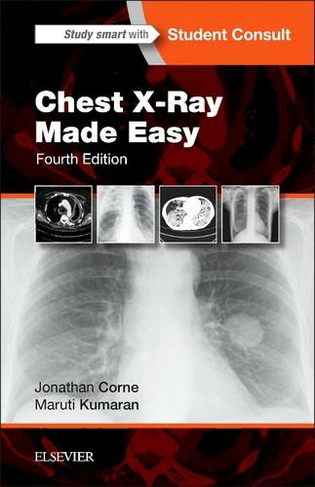 Chest X-Ray Made Easy: (Made Easy 4th edition)