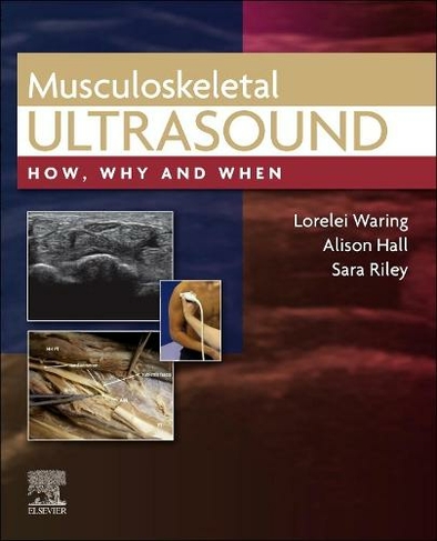 Musculoskeletal Ultrasound: How, Why and When (How, Why and When)