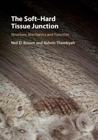 The Soft-Hard Tissue Junction: Structure, Mechanics and Function