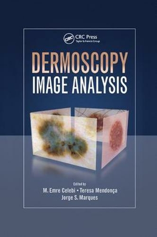 Dermoscopy Image Analysis: (Digital Imaging and Computer Vision)
