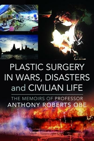 Plastic Surgery in Wars, Disasters and Civilian Life: The Memoirs of Professor Anthony Roberts OBE