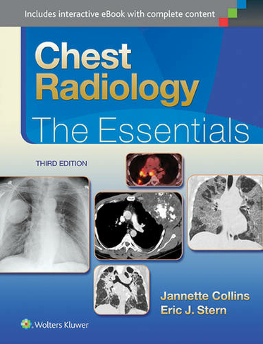 Chest Radiology: The Essentials: (Essentials Series 3rd edition)