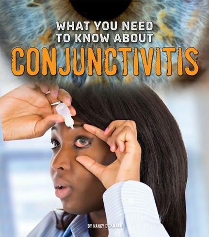What You Need to Know about Conjunctivitis: (Focus on Health)