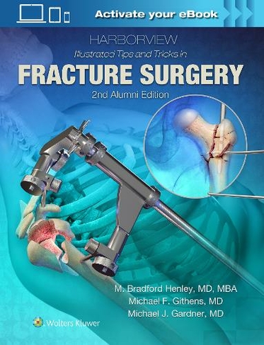 Harborview Illustrated Tips and Tricks in Fracture Surgery: (2nd edition)