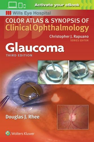 Glaucoma: (Color Atlas & Synopsis of Clinical Ophthalmology 3rd edition)
