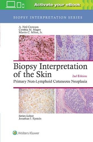 Biopsy Interpretation of the Skin: Primary Non-Lymphoid Cutaneous Neoplasia (Biopsy Interpretation Series 2nd edition)