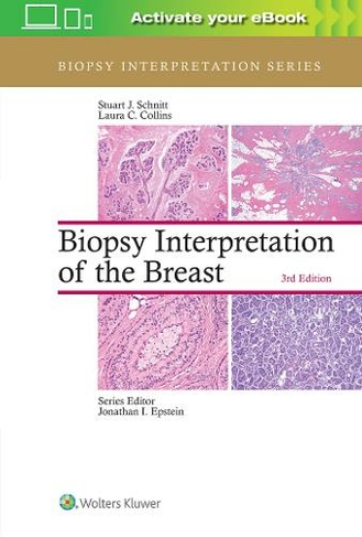 Biopsy Interpretation of the Breast: (Biopsy Interpretation Series 3rd edition)