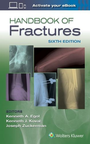 Handbook of Fractures: (6th edition)