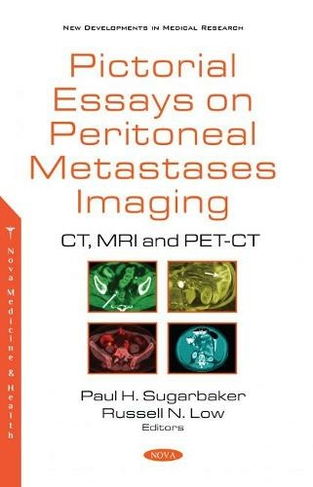 Pictorial Essays on Peritoneal Metastases Imaging: CT, MRI and PET-CT