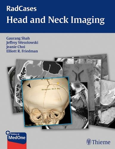 RadCases Head and Neck Imaging: (Radcases Plus Q&A)