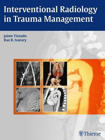 Interventional Radiology in Trauma