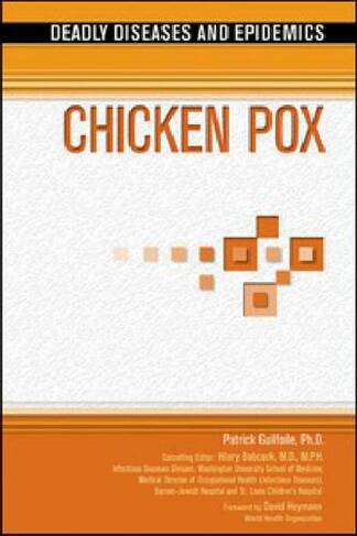 Chicken Pox: (Deadly Diseases and Epidemics)