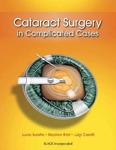Cataract Surgery in Complicated Cases