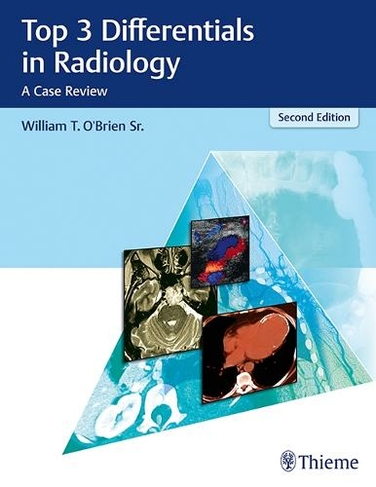 Top 3 Differentials in Radiology: A Case Review (Top 3 Differentials 2nd New edition)