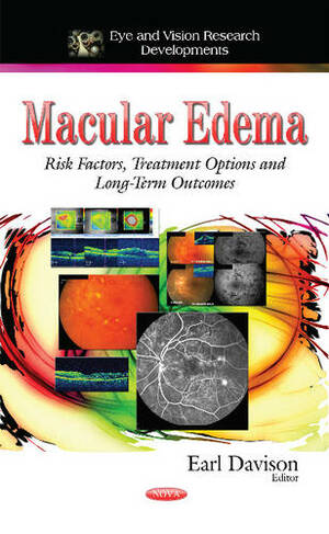 Macular Edema: Risk Factors, Treatment Options and Long-Term Outcomes