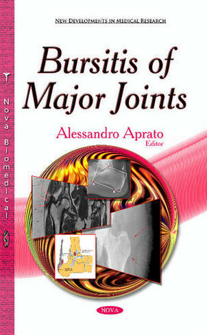 Bursitis of Major Joints