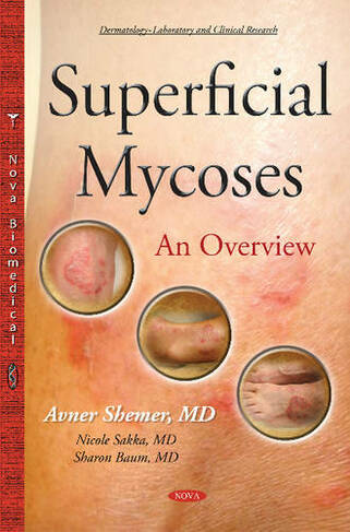 Superficial Mycoses: An Overview