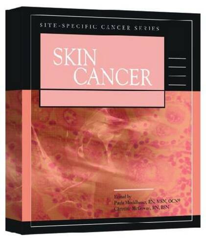 Skin Cancer: (Site-Specific Cancer Series)