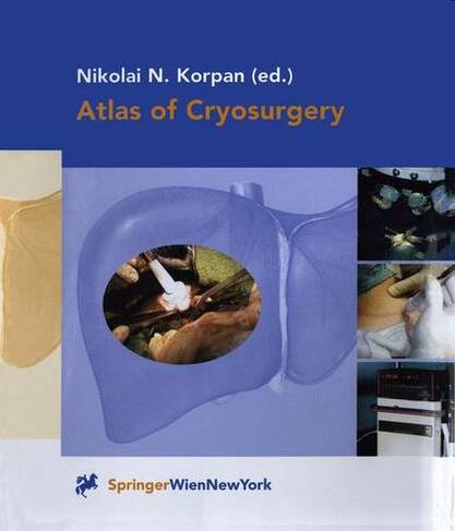 Atlas of Cryosurgery Softcover reprint of the original 1st ed. 2001