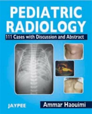 Pediatric Radiology: 111 Cases with Discussion and Abstract