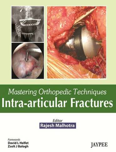 Mastering Orthopedic Techniques: Intra-Articular Fractures