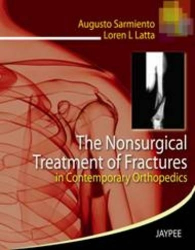 The Nonsurgical Treatment of Fractures in Contemporary Orthopedics