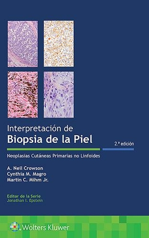 Interpretacion de biopsias de la piel: Neoplasias cutaneas primarias no linfoides (2nd edition)