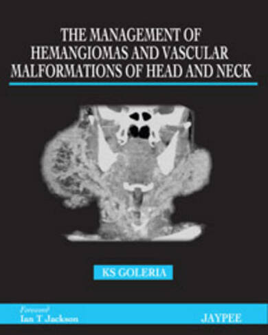 The Management of Haemangiomas and Vascular Malformations of Head and Neck