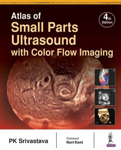 Atlas of Small Parts Ultrasound: with Color Flow Imaging (4th Revised edition)